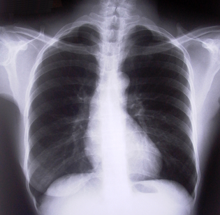 A deeper inside view: The future of medical imaging