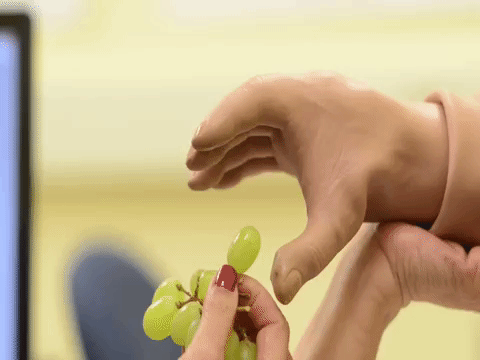 RESEARCHERS TREAT AMPUTEES BY STIMULATING NERVES IN FDA TRIAL