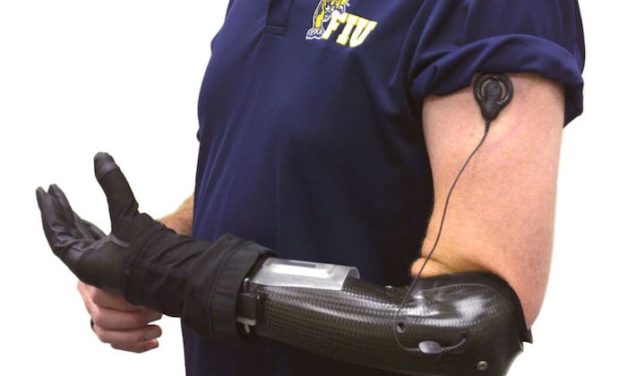 Department of Defense awards FIU biomedical engineering team $6 million to expand testing of pioneering prosthetic hand system