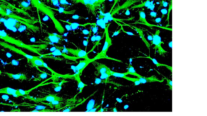 ASU scientists boost gene-editing tools to new heights in human stem cells