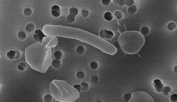 Can microbes save us from PFAS?
