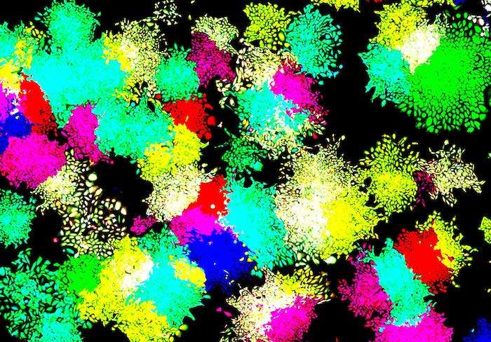 Simple Gene Circuits Hint at How Stem Cells Find New Identities