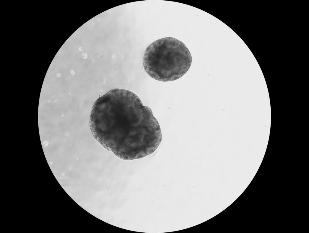 A low magnification image of organoids derived from patient blood or skin cells reprogrammed into cell cultures.