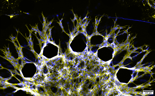 image of a tumor-on-a-chip